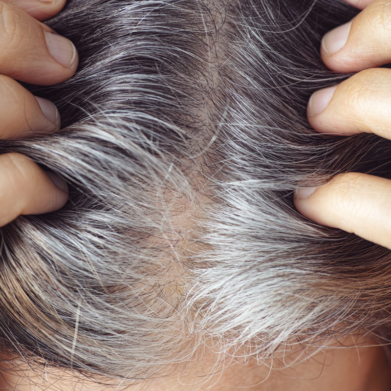 Going Grey Early? Understand the common causes, deficiencies and nutrients